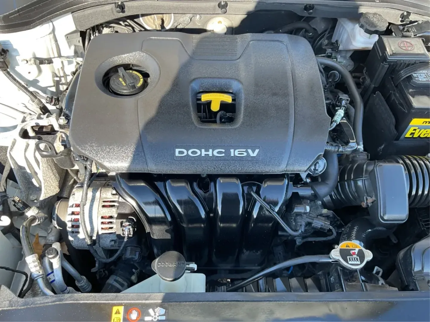 2017 Hyundai Elantra SE (5NPD84LF2HH) with an Nu 2L I-4 DOHC engine, 6A transmission, located at 1230 East Main St, Xenia, OH, 45385, (937) 908-9800, 39.688026, -83.910172 - Discover your next adventure with the 2017 Hyundai Elantra SE, available now at Advantage Car and Credit - Piqua! This stylish sedan is perfect for budget-conscious buyers looking for a reliable vehicle that effortlessly blends comfort, performance, and technology. Whether you're commuting to work, - Photo#11